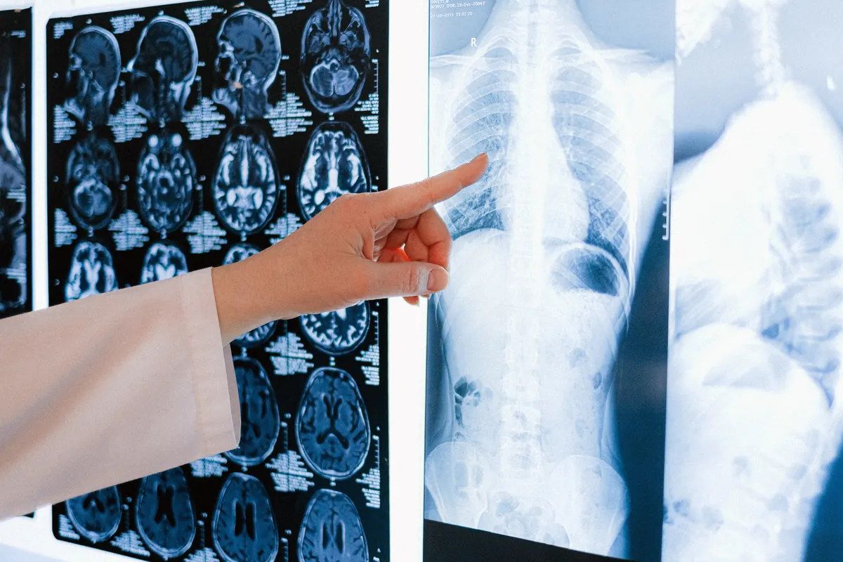 A clinician reviewing radiology images.