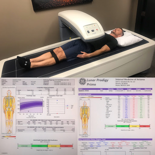 http://www.topdocsaz.com/dxa-body-composition-analysis/